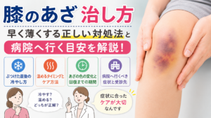 膝のあざ 治し方｜早く薄くする正しい対処法と病院へ行く目安