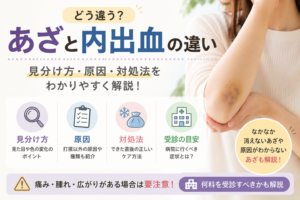 あざと内出血